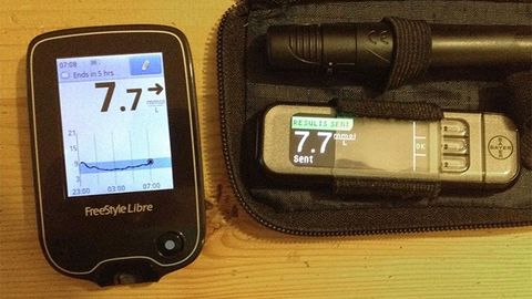 Abbott Freestyle Libre Results vs BG meter