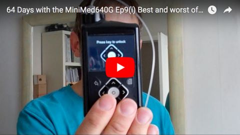 The best and the worst of 64 days with the Medtronic MiniMed 640G